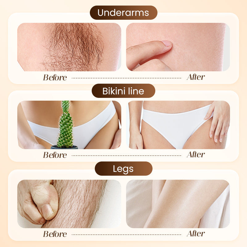 💞LAST DAY BUY 1 GET 1 FREE💞Bikini Hair Removal Cream for Sensitive Skin | Suitable for Men & Women |